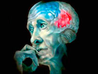 Старение мозга - одна из причин старения