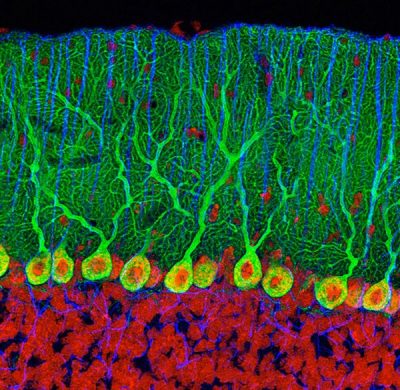 Нейроны Пуркинье в мозжечке (фото Thomas Deerinck)