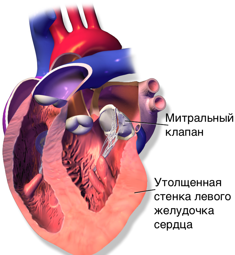 Левый желудочек. Желудочек сердца. Левый жедудочек сержце. Левый и правый желудочек сердца.